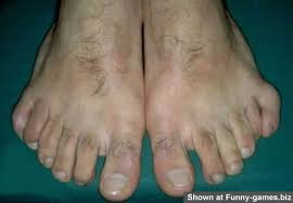 Name:  hairy feet.png
Views: 562
Size:  67.2 KB