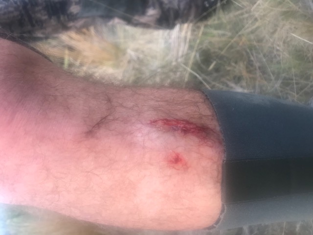 Name:  Bruise.jpg
Views: 494
Size:  56.0 KB
