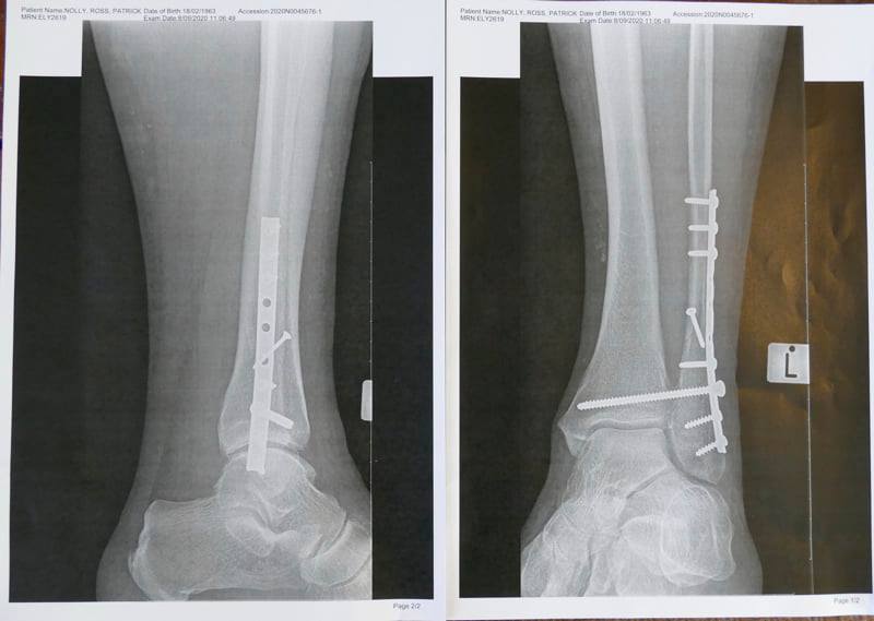 Name:  x ray.jpg
Views: 152
Size:  40.4 KB